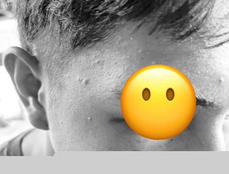 Motorist Suffers Eye Injury After Alleged Punch by Traffic Enforcer in Roxas City