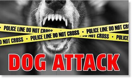 86-year-old Southern California man fatally mauled by Rottweilers during morning walk