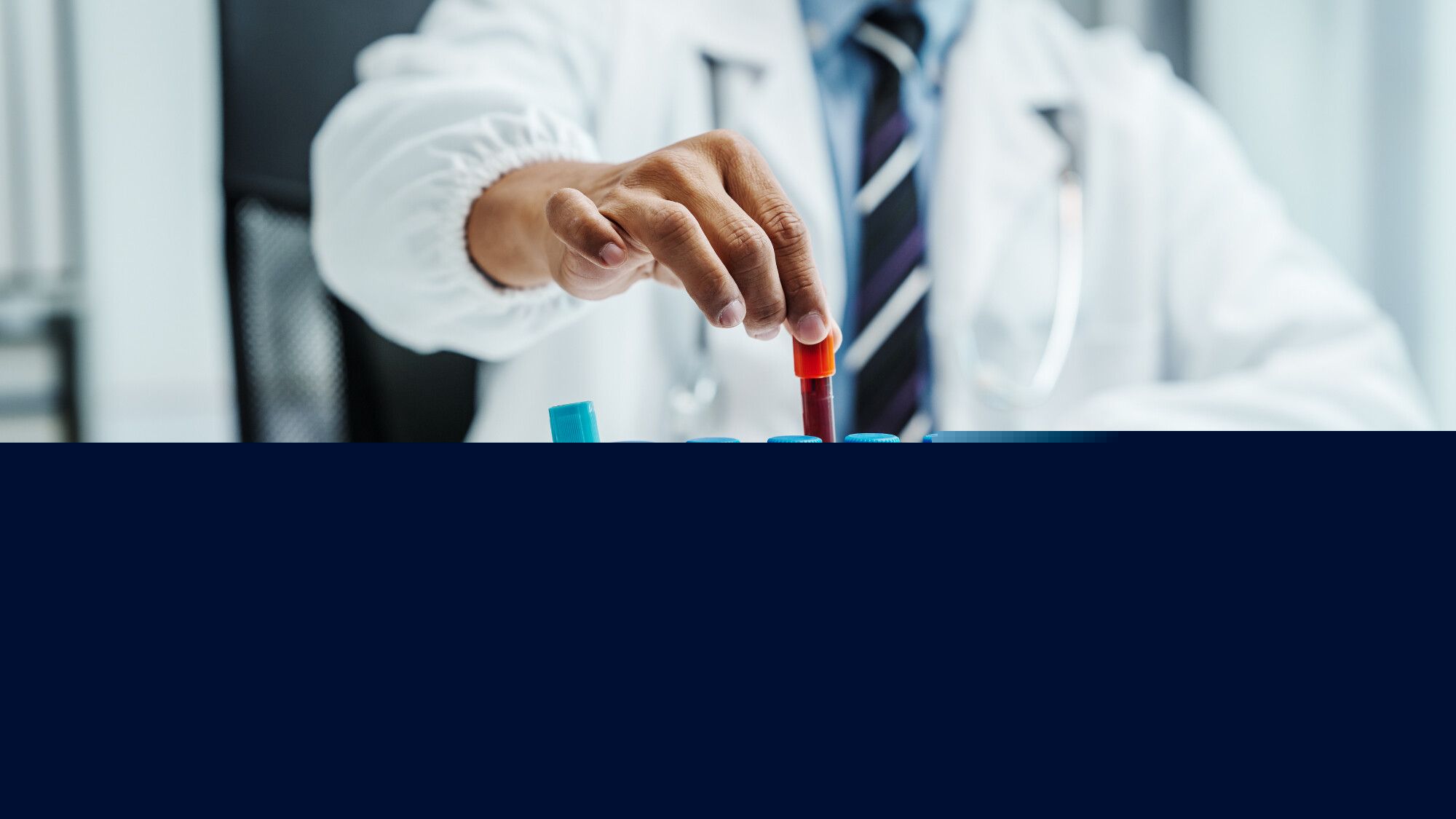 Oméga 3, vitamine D et B, zinc… Quels tests pour savoir si vous êtes carencé?