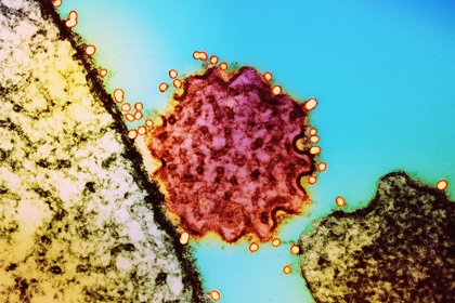 Chiz to health, border authorities: Keep protocols and preparedness systems fully active vs Nipah