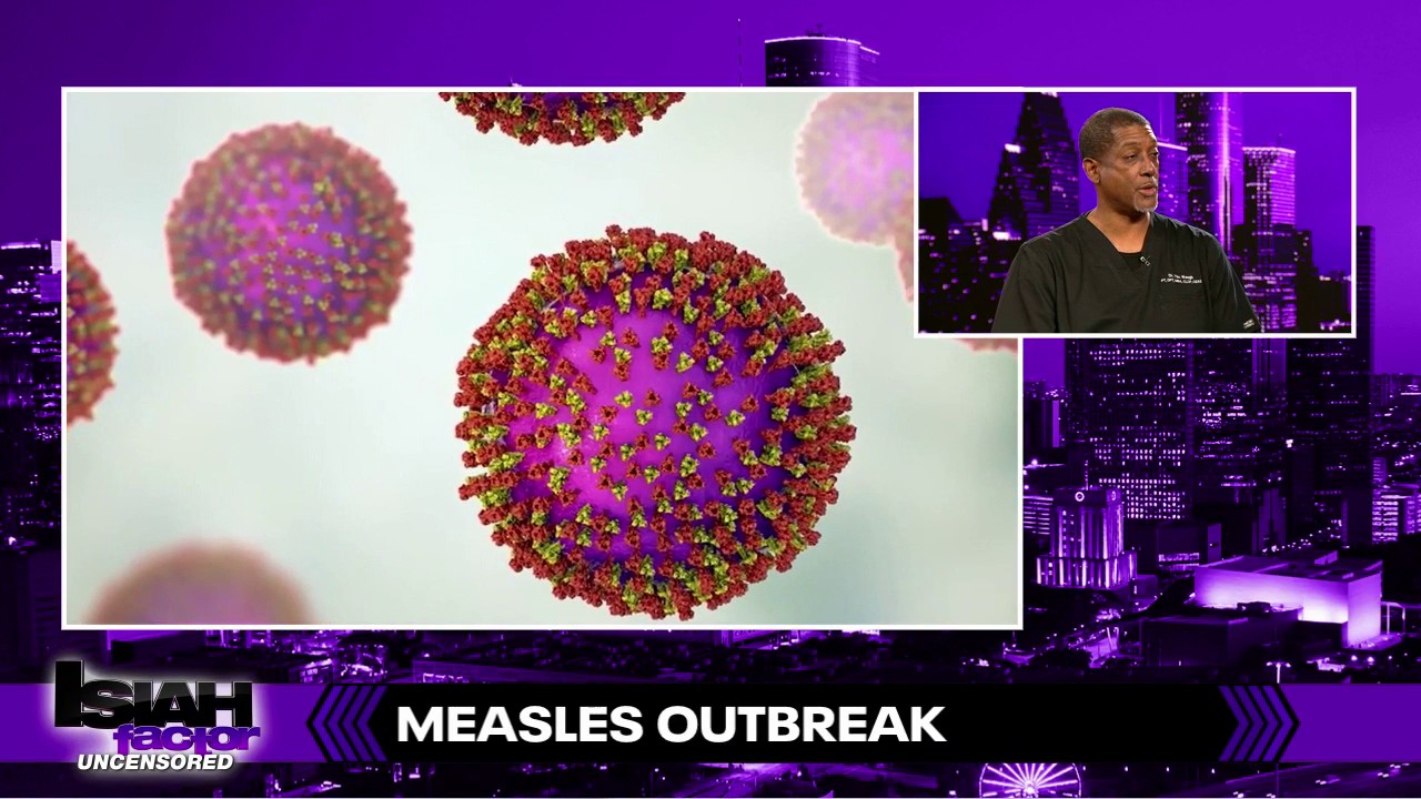 Measles outbreak in South Carolina outpaces 2025 cases in Texas