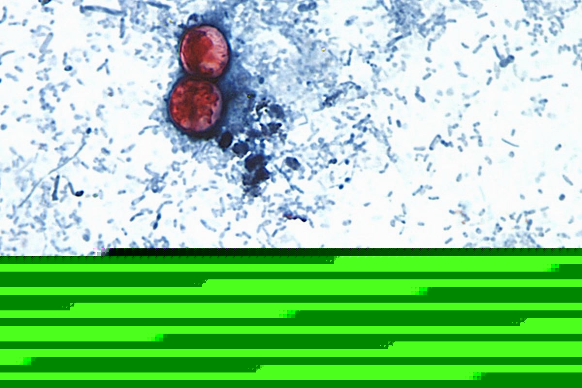 15 states now linked to iceberg lettuce cyclospora outbreak, CDC says