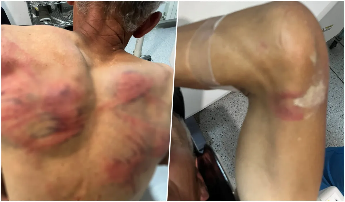 Trajković pisao institucijama EU, Kvinte i OEBS-a, traži istragu o prebijanju Raškovića u selu Dren