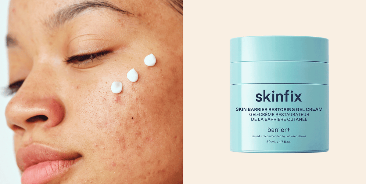 The 13 Best Moisturizers for Acne-Prone Skin That Won’t Break You Out