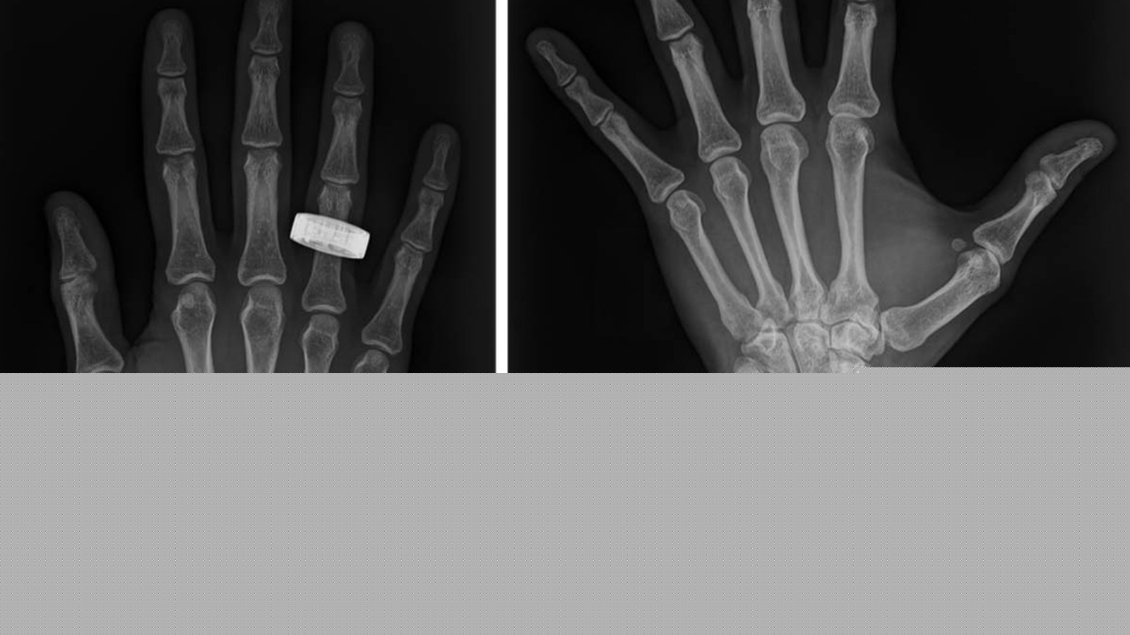 First-Ever Medical X-Rays In Space Could 'Change The Game' For Astronauts' Health