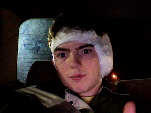 Comment on My Tympanoplasty, A Retrospective by Corrie Rose
