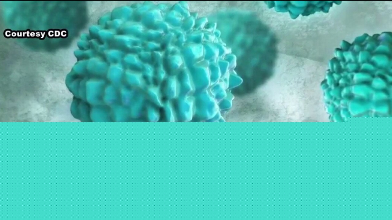 Cyclospora outbreak now linked to Illinois, 3 other states