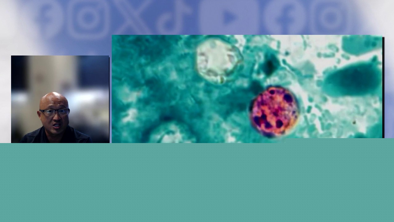 Cyclospora: Fact or Fiction?