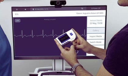 Prophylactic Pacemaker Use After TAVR Shows Low Pacing Burden: JACC
