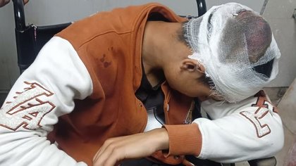 Attacked With Iron Rod: 18-year-old Kashmiri vendor assaulted in Uttarakhand; Full story here