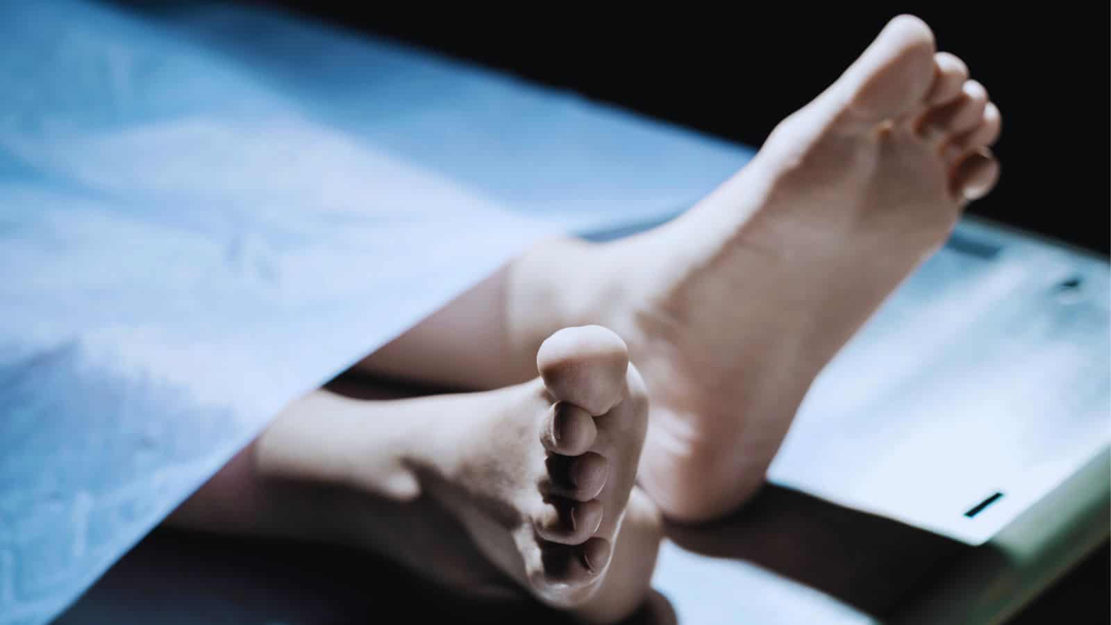 Woman’s burnt body found in garbage dump in Domalguda