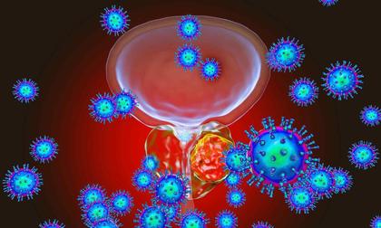 Bout of cystitis may signal presence of urogenital cancers in middle-aged adults,  suggests study