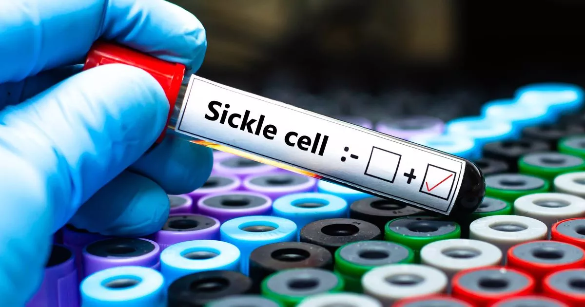 Find out if you carry specific 'trait' with one 'simple, free blood test', NHS says