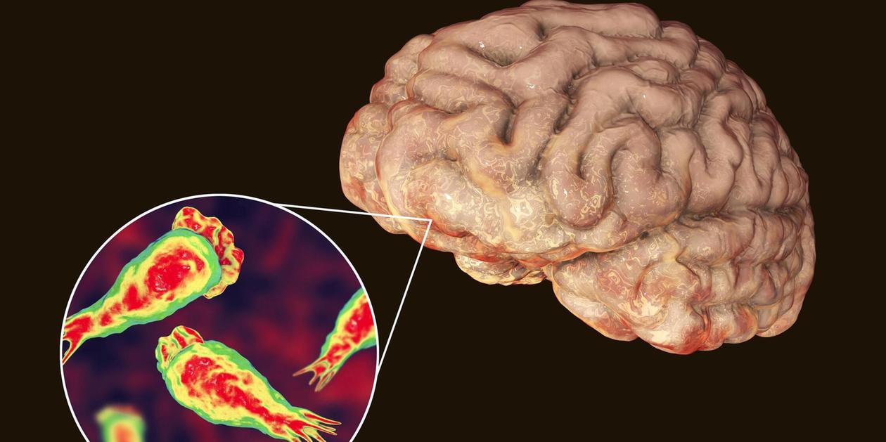 Tödlicher als Ebola: Gehirnfressende Amöbe lauert in Badeseen und Schwimmbädern