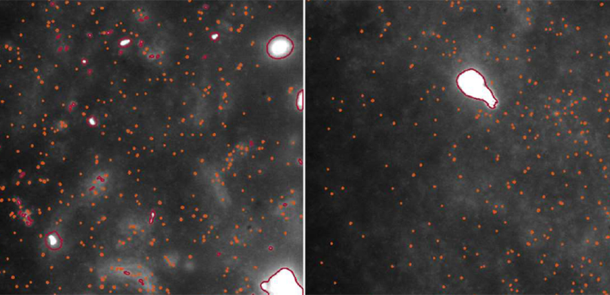 Parkinson’s ‘trigger’ directly observed in human brain tissue for the first time