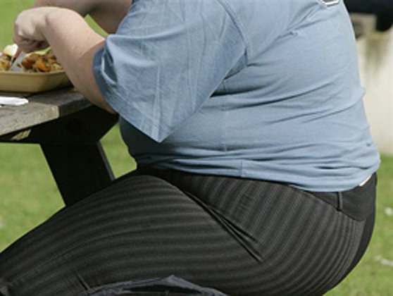 România conduce clasamentul la obezitate: patru din zece români au această boală. Până în 2030, 11 milioane de români vor avea indicele de masă corporală peste limita normală