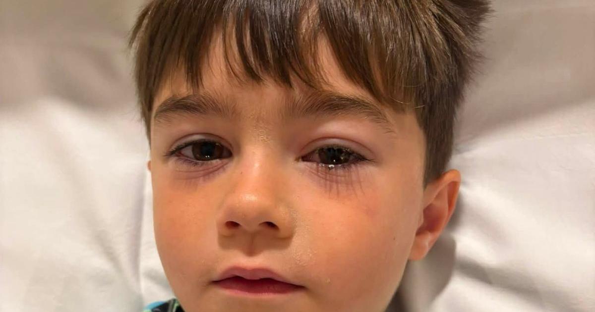 Four-year-old rushed to hospital after toy bought from Shein 'exploded in face'