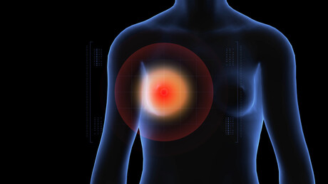 Beta blockers could halt triple negative breast cancer