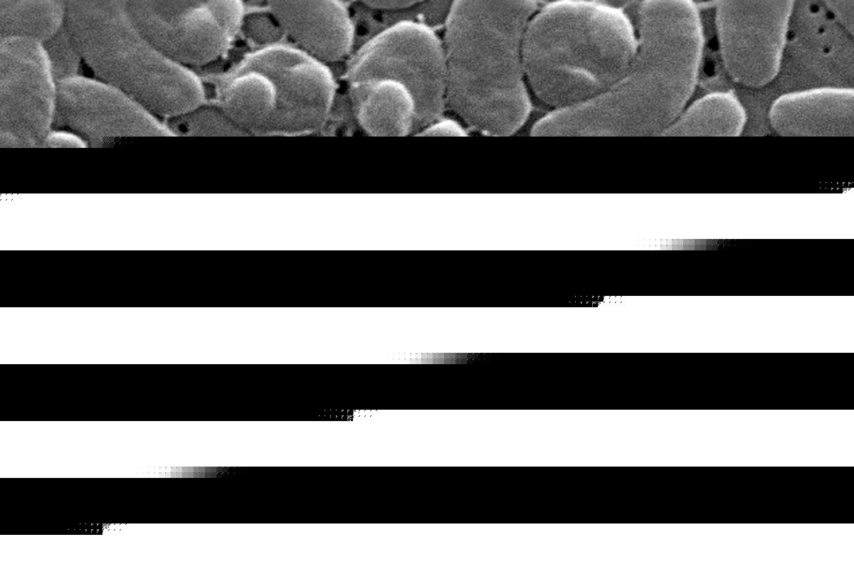 Health officials urge caution for Gulf Coast beachgoers during surge of deadly bacterial infections