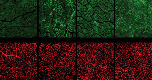 Virus-like particles deliver gene-editing tools into Duchenne mouse model