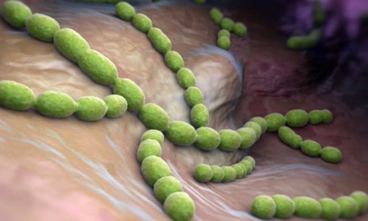 Comment on 10 Nightmarish Flesh-Eating Pathogens That Consume Humans by 10 Nightmarish Flesh-Eating Pathogens That Consume Humans – Listverse – Links