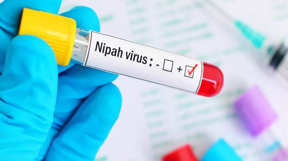Common Symptoms of Nipah Virus You Should Know