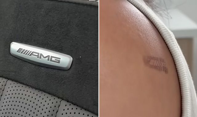 Drivers sue Mercedes-Benz and allege car’s logo gave them burns