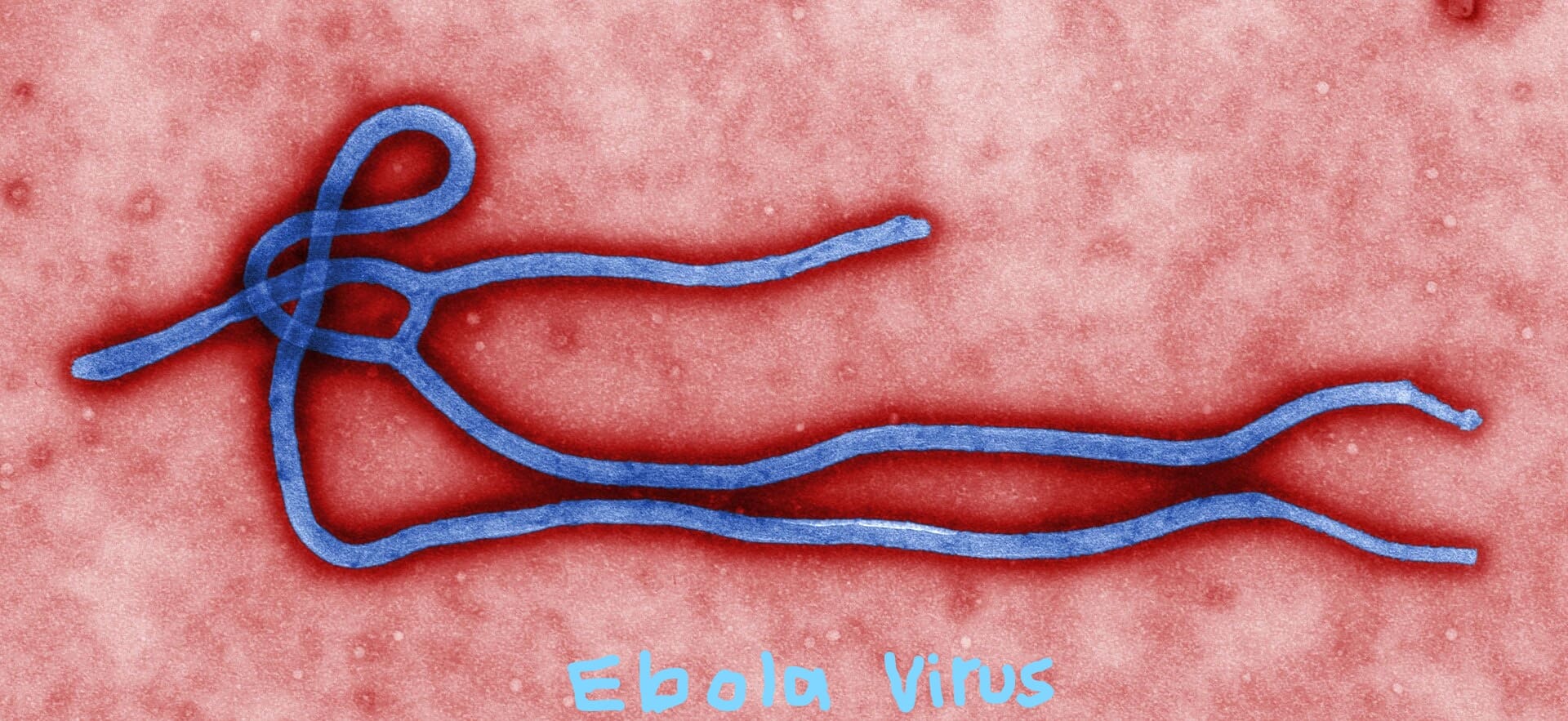 Ebola outbreak contained in major African country