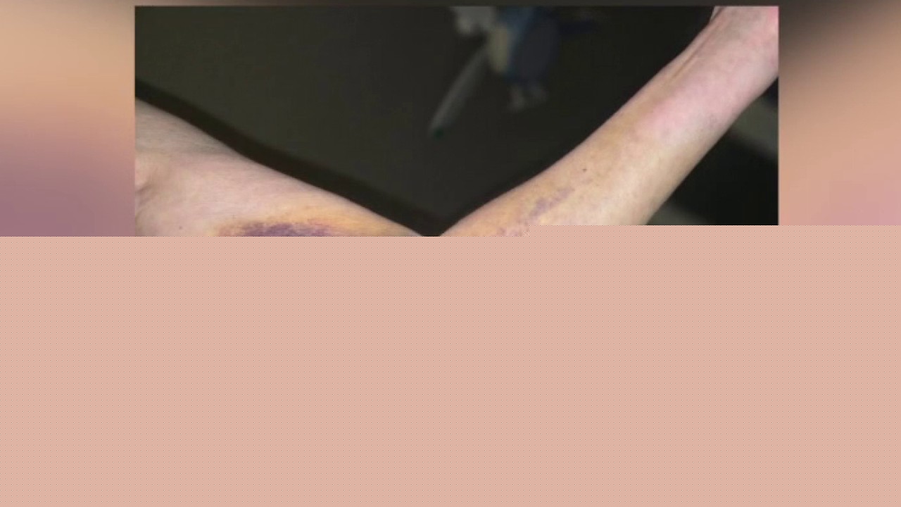 Lago Vista road rage assault victim speaks out