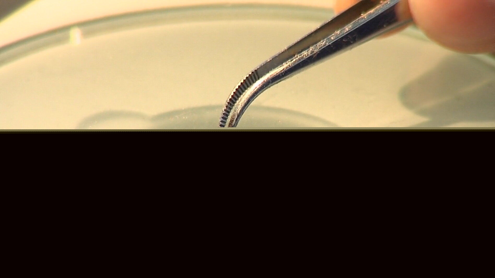North Dakota reports 1st West Nile case of 2026; Cass County resident hospitalized