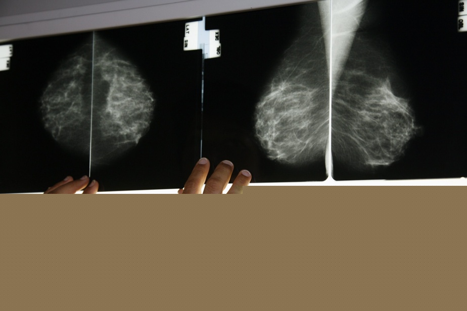 L’accès au dépistage du cancer du sein pourrait être élargi « très prochainement »