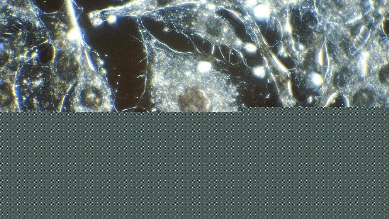 Breakthrough Cancer Therapies Turn Many Deadly Tumors Into Treatable Diseases