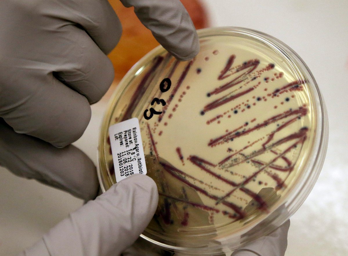Health officials remind citizens to take precautions against Cyclospora