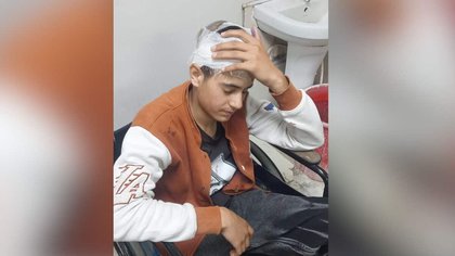 Musalmaan hai, maaro: Kashmiri teen attacked with iron rod in Uttarakhand