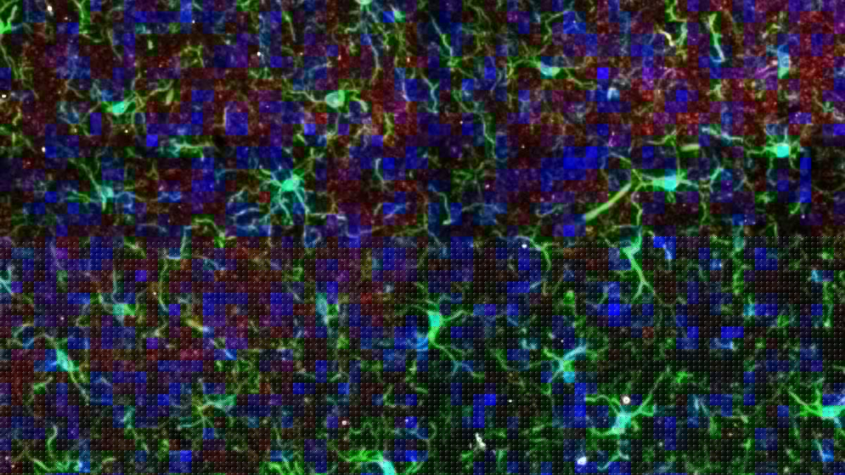 Ketamine Alters Brain Structures – But Only in One Sex, Study in Mice Finds