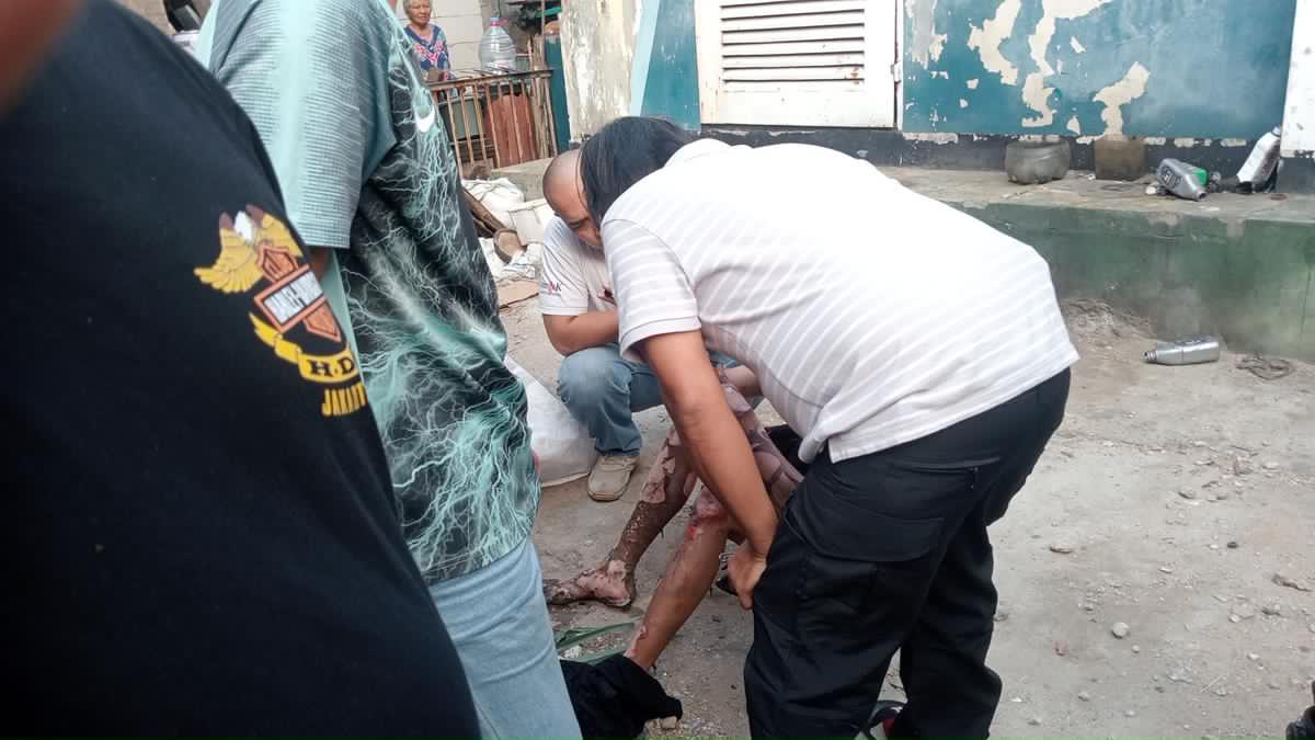 Diduga Curi Kabel, Pria Terbakar Akibat Sengatan Listrik
