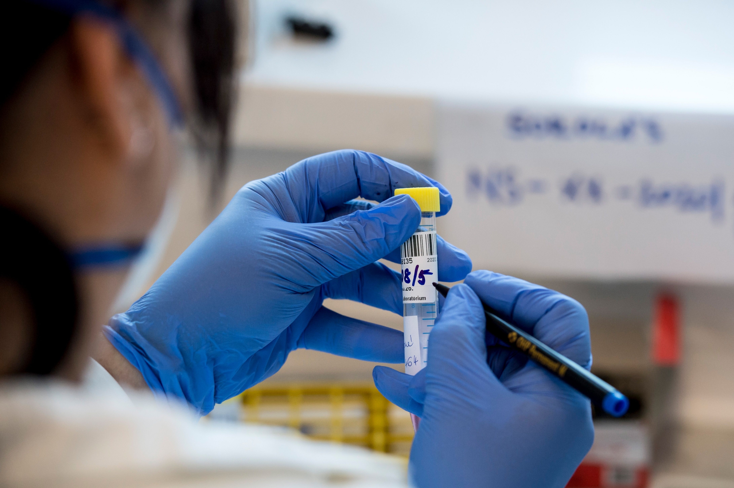 Lab Labeling Error Allegedly Led to Cancer Misdiagnosis and Unnecessary Hysterectomy