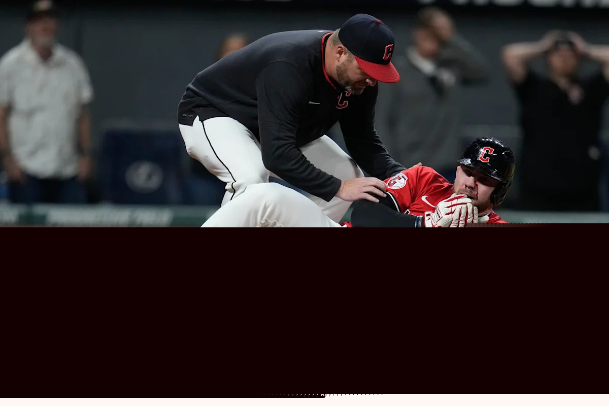 Guardians' David Fry carted off field after being hit in face by pitch while trying to bunt