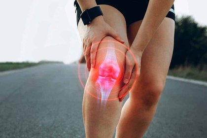 Osteoartritis: avance revelador cambia el futuro del dolor
