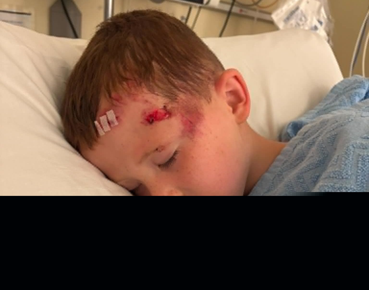Mother of injured child calls for e-scooter ban for under 21s