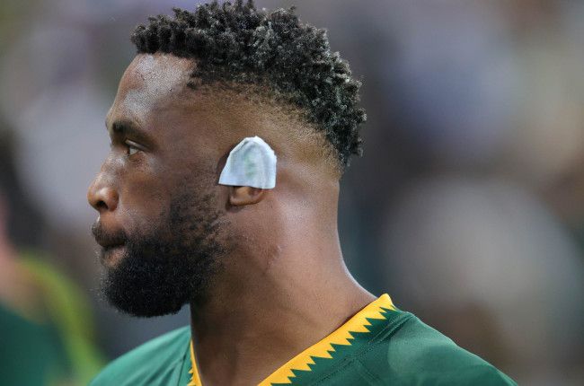 Boks battle to victory as Kolisi injury casts shadow over Argentina win