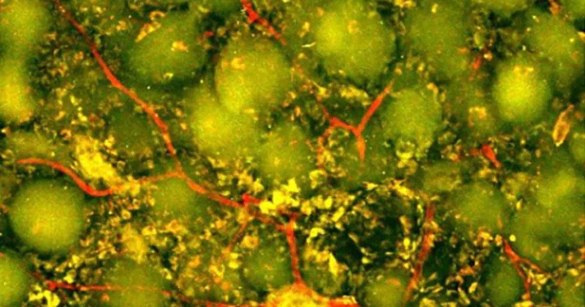 A Shot at Healing the Brain
