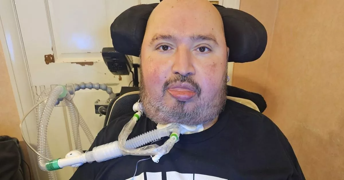 Man should have died decades ago from condition that tuned his legs rock solid