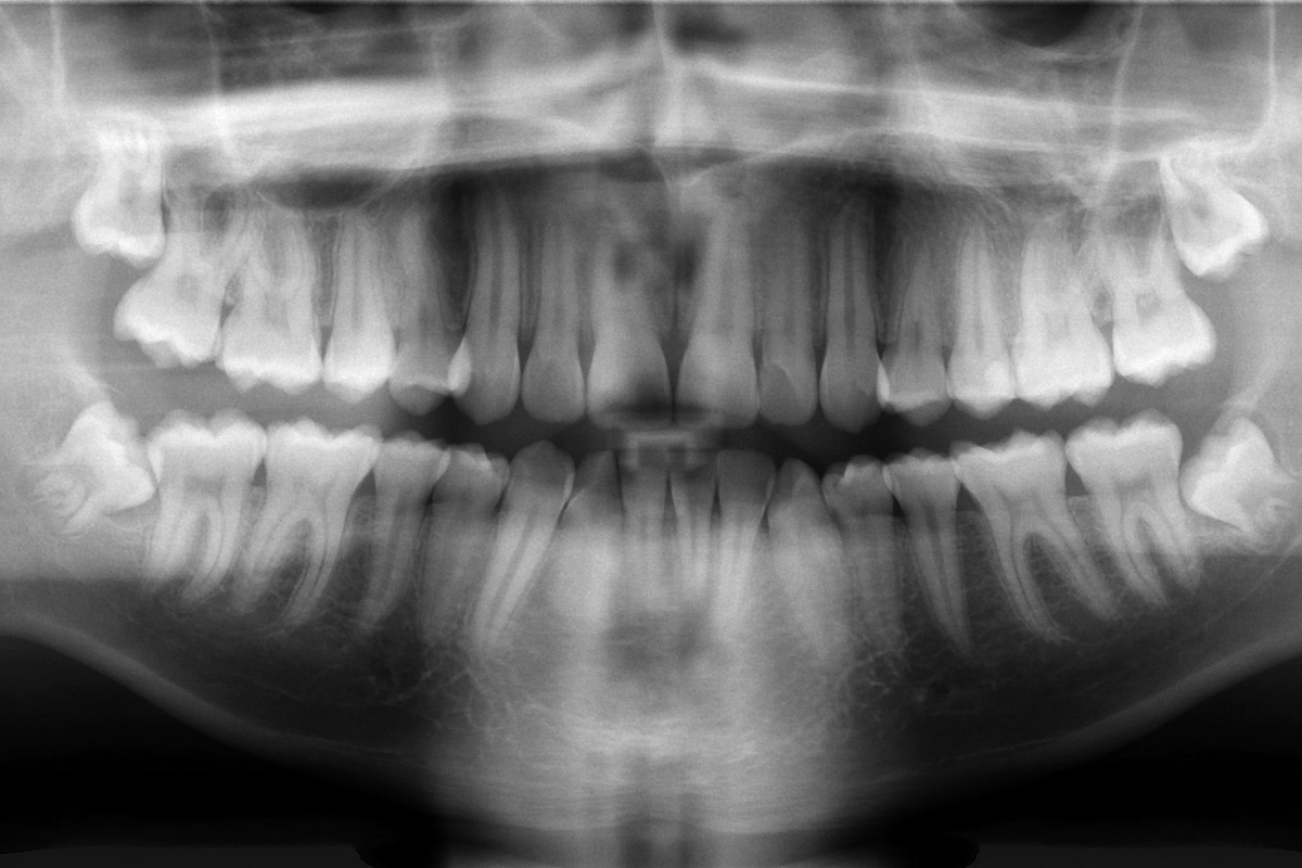 Comment on Regrowing Teeth Might Not Be Science Fiction Anymore by Anonymous