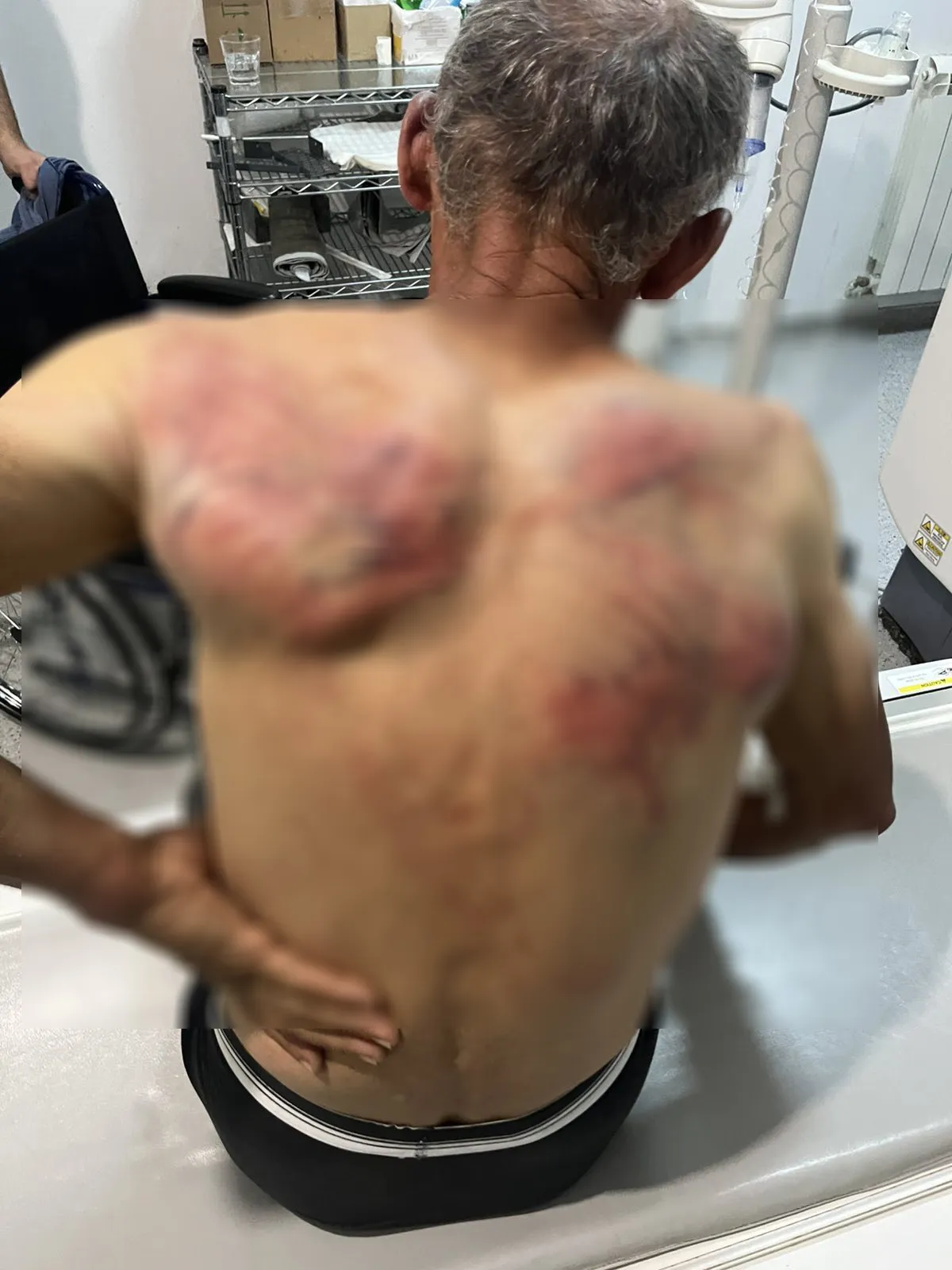 Srpska lista: Kosovska policija upala u kuću Nenada Raškovića, tukla ga, vezala za drvo i tražila da prizna ratni zločin (FOTO)