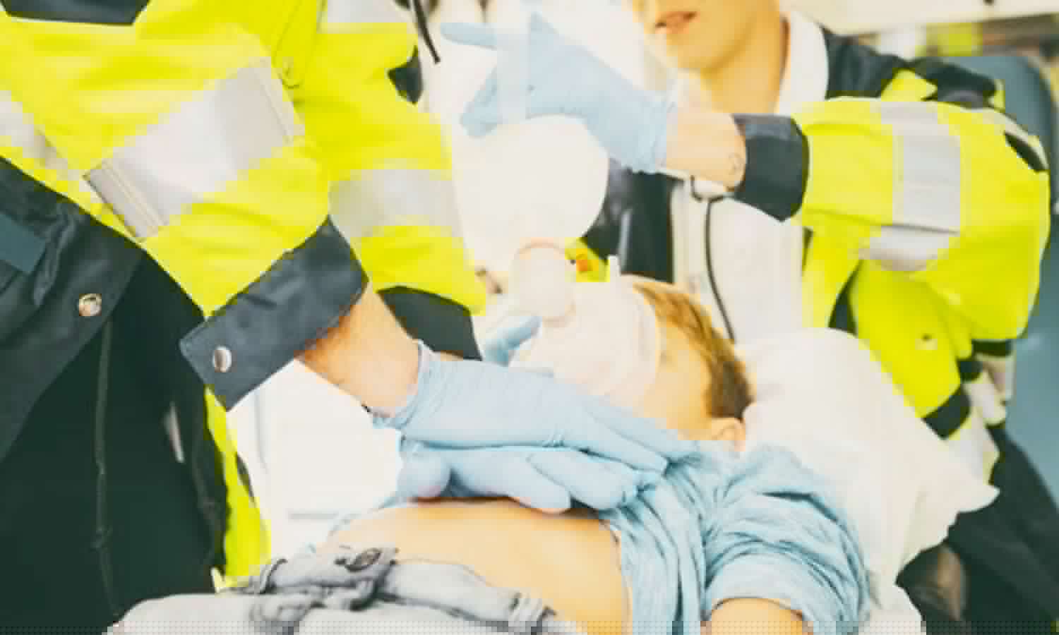 Early Automated External Defibrillator Pad Application Improves Outcomes After Pediatric Cardiac Arrest: JAMA