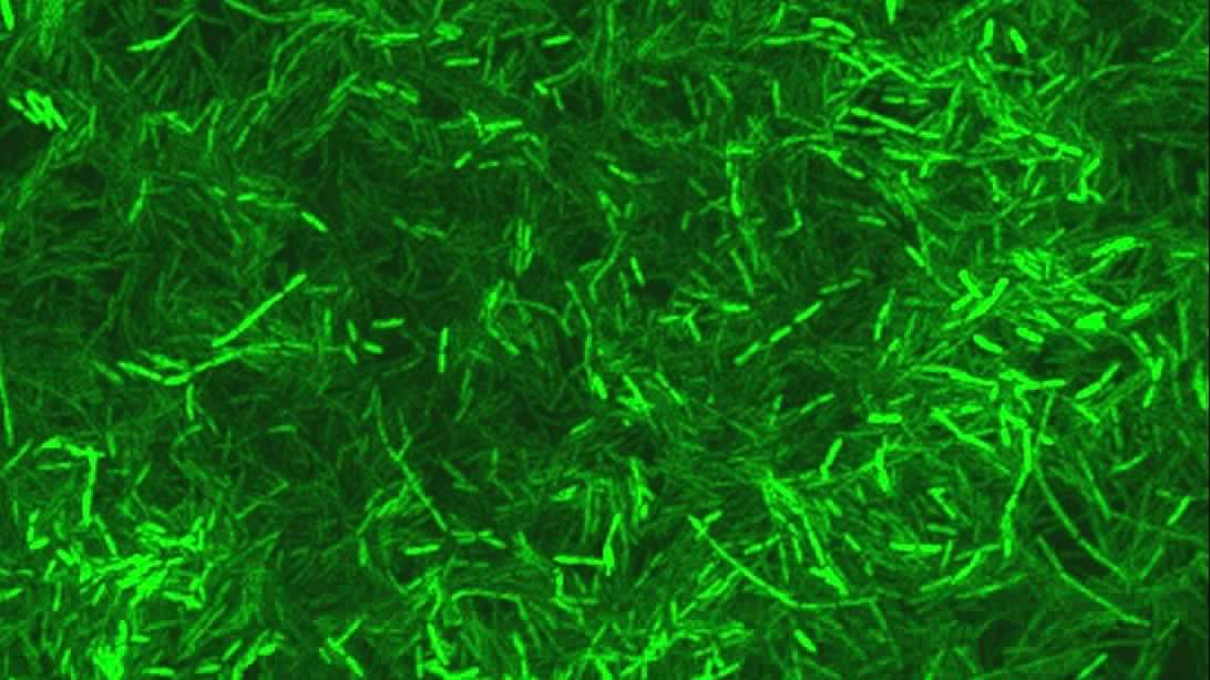 Antibiotika: Extreme Resistenz laut Studie durch Umweltbakterien ausgelöst