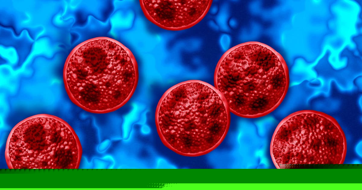 Cyclosporiasis Michigan outbreak: Case count at 6,571 Tuesday