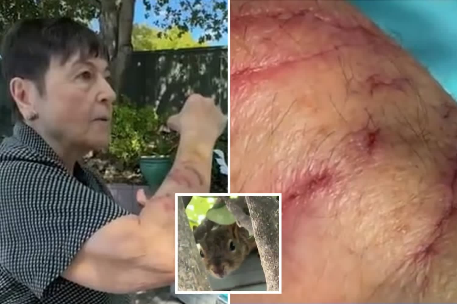 Vicious squirrel attacks send two people to the ER as neighbors warn creature ‘appears from nowhere’ to maul faces