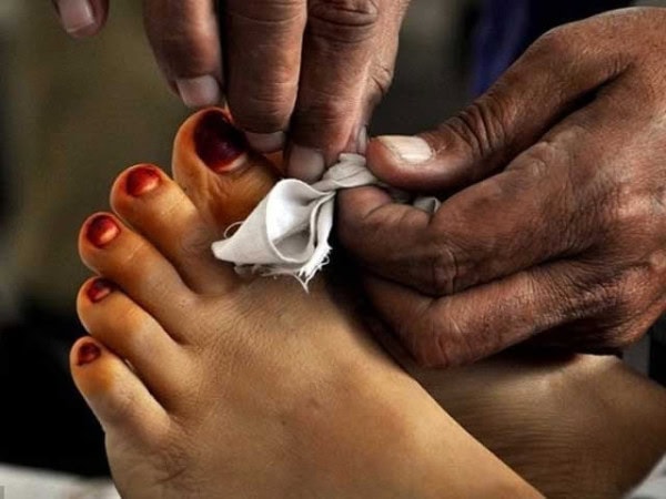 Woman dies in acid attack by husband following divorce suit in Rahim Yar Khan